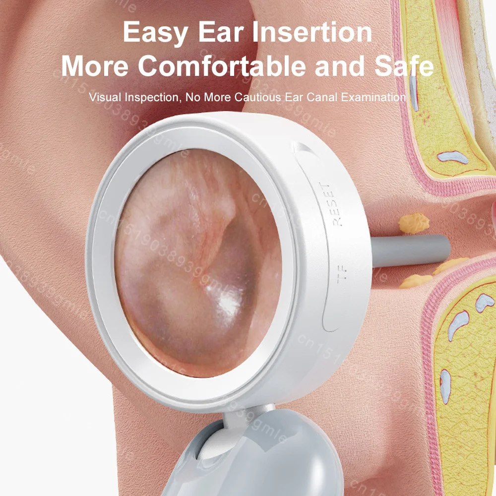 

Electronic Ear Otoscope Camera Portable Ear Care Tool,1080P High-Definition,good for Earwax Removal,safe for Kids, Adults, Pets