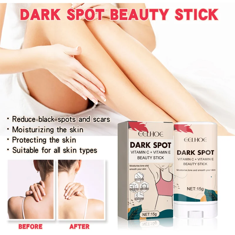 

Dark Spot Beauty Stick Dark Knuckles Fast Brighten Cream Elbows Hand Knuckle Brightening Revives Dull Skin Nourishes Skin Whiten