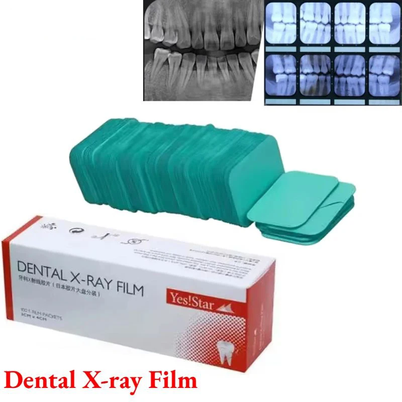100Pcs Dental X-ray Film 3*4cm HD Intraoral Imaging System for Digital Cameras Radiovisiograph Dental Materials
