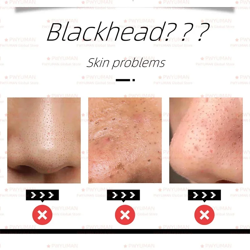 

Remove Blackhead Large Pores Serum Face Pore Shrinking Minimizing Firm Smooth Repair Moisturizer Oil Control Korea Skin Care Set