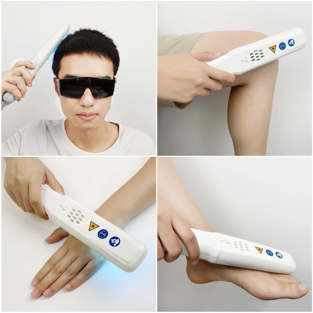 SIGMA Professional 311nm Narrowband UVB Phototherapy Device Class II Online Technical Support for Vitiligo Psoriasis Treatment