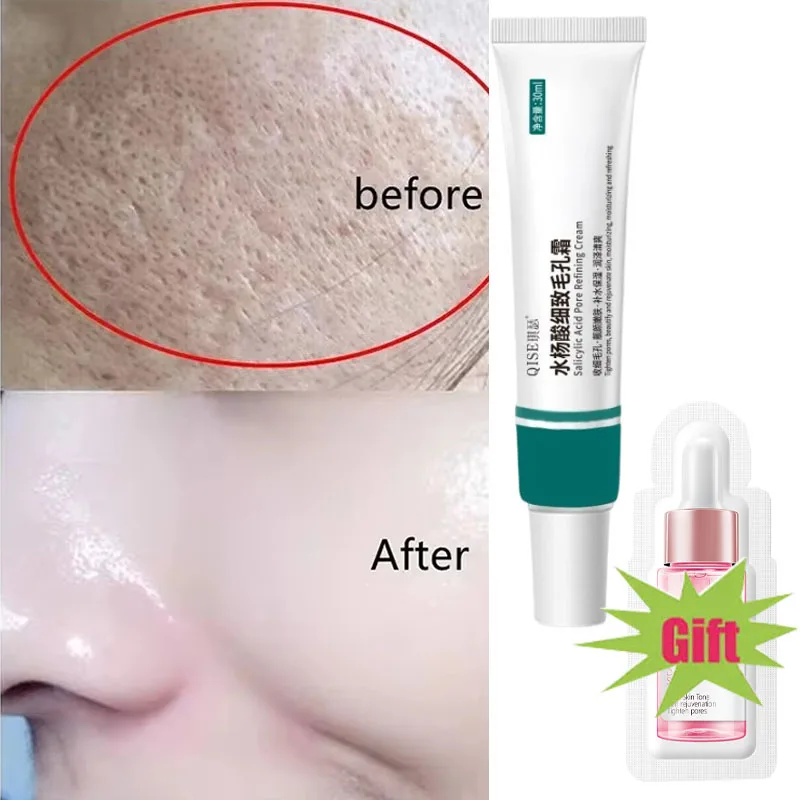 Salicylic Acid Pore Shrinking Serum Cream Quick Elimination Large Pores Remove Black Head Tighten Face Smooth Skin Care Products