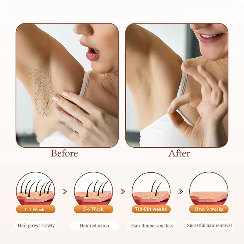 Freezing Point Hair Removal Device Sapphire Household Full Body Private Parts High Energy PainlessiplIntense Pulsed Light Epilat
