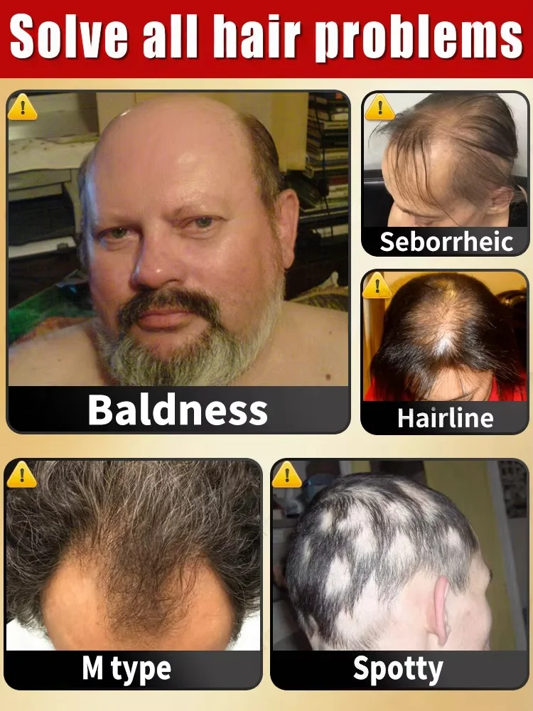 100% revive hair, strong penetration, activate hair roots, more hair, say goodbye to baldness, thick hair