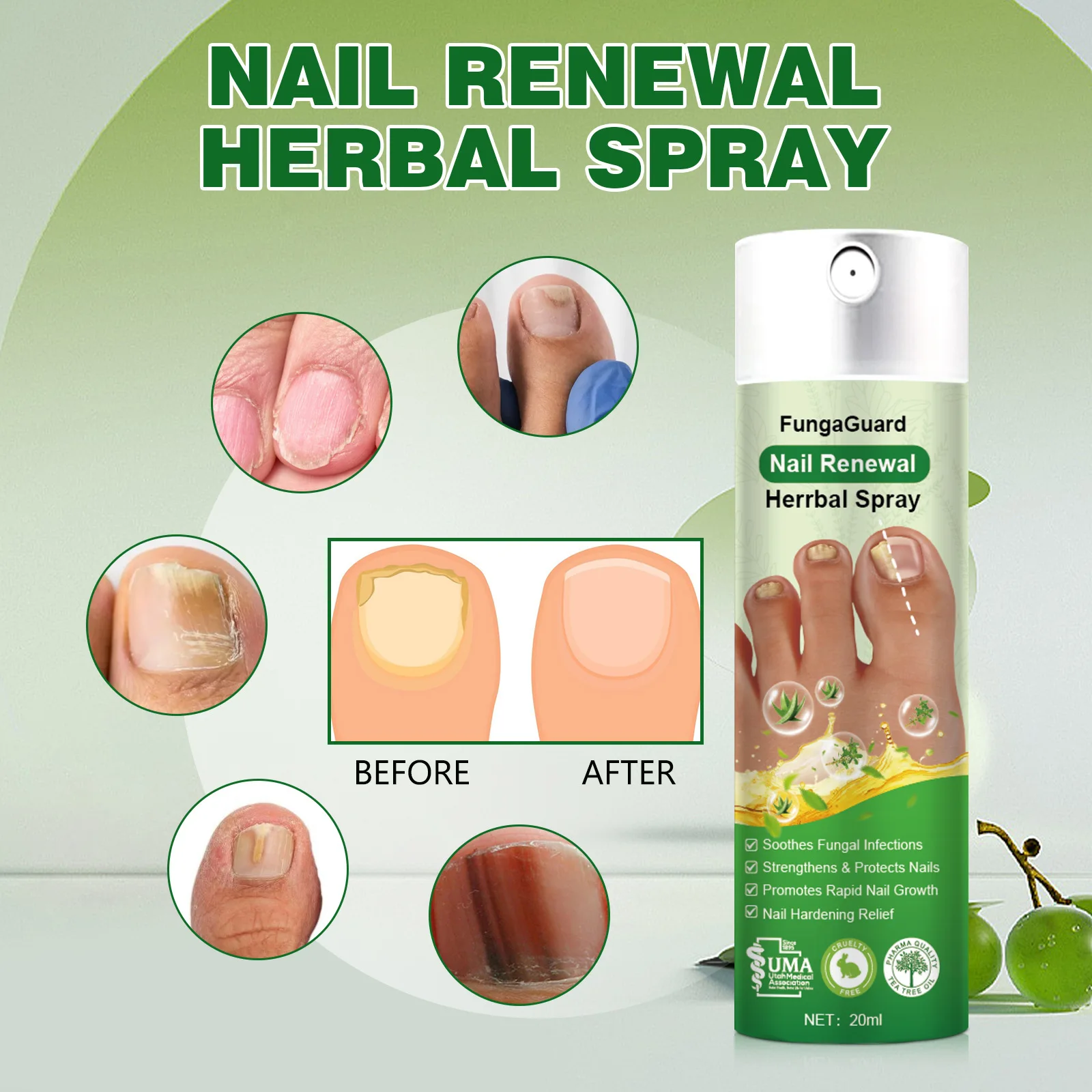 Nail-Fungal Treatments For Toenails Herbal Ingredients For Remove Onychomycosis Treatment Gentle Nourishing Nail Care Products
