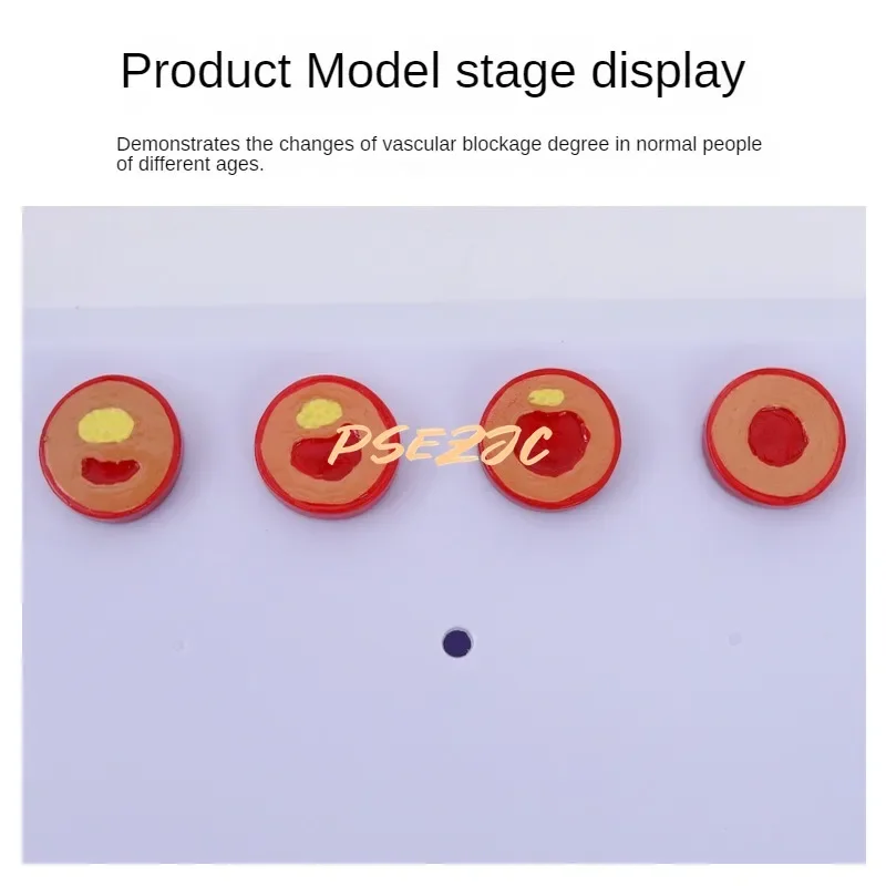 PVC Coronary Cardiovascular Model Sclerosis Elderly Heart  Vascular  Medical Teaching Supplies