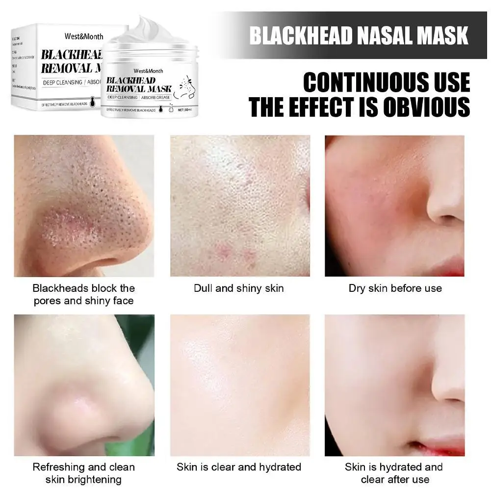 Dissolvant de points noirs, masque antarctique, bande de pores, déchirure, soins de l'acné profonde, peeling, traitement des points noirs, patch nasal de la peau