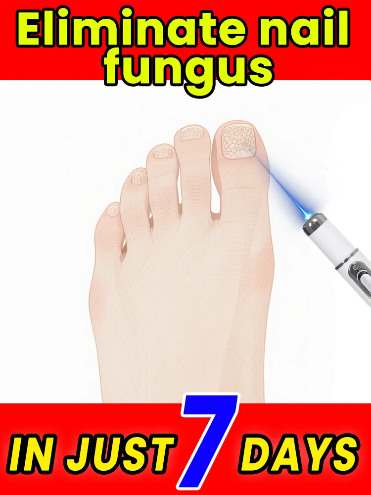 

The best choice for treating onychomycosisprofessionally helping nail recovery