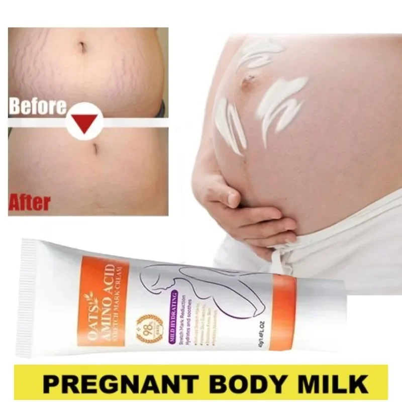 Stretch Marks Permanent Removal Eliminate Body Belly Stretch Marks Swelling Marks Remove Skin Cracks Repair Firming Care