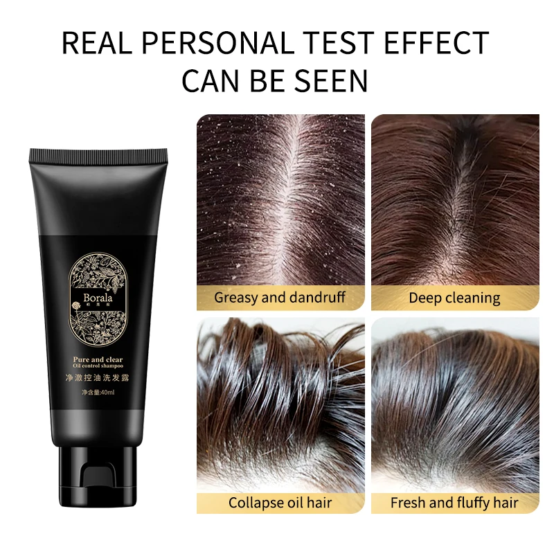 

Shampoo Hair Strengthen Moisturizer Refreshing Oil Control Anti-dandruff Deep Cleansing Hair Scalp Nourishing Hair Scalp Care