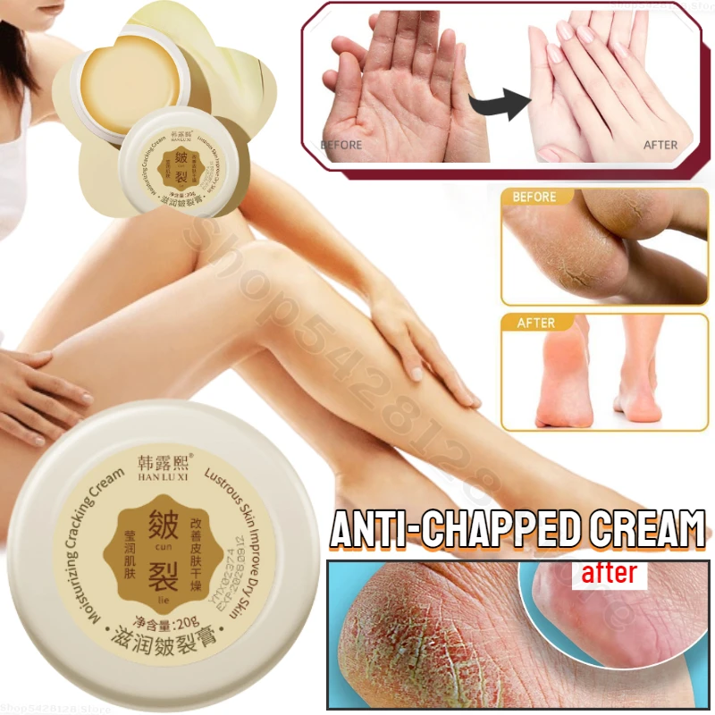 

Dry Crack Peeling Repair Cream Nourishing Dryness Foot Heel Dead Skin Removal Soothes Anti Chapping Moisturizing Chapped Cream