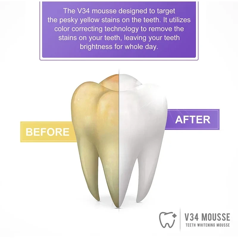 Mousse V34-pasta de dientes para limpieza bucal, pasta de dientes blanqueadora efectiva, elimina manchas de dientes amarillas