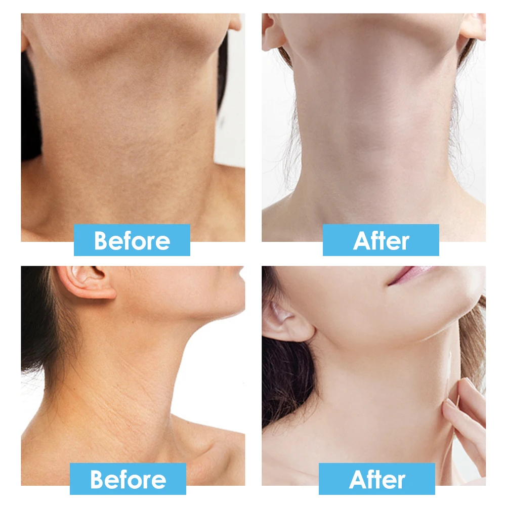 10 stücke Ziegenmilch Hals maske Hälse Haut masken straffende aufhellende Hals masken feuchtigkeit spendende Schönheits hälse Hals falten reduktion pflaster