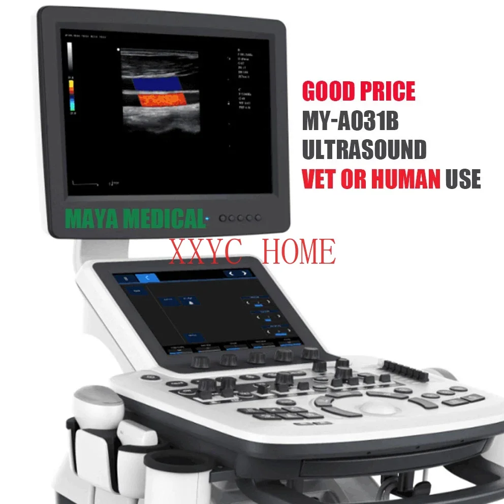 Trolley Scan Machine Medical Equipment System Color Doppler 3d 4d Ultrasound Machine Human