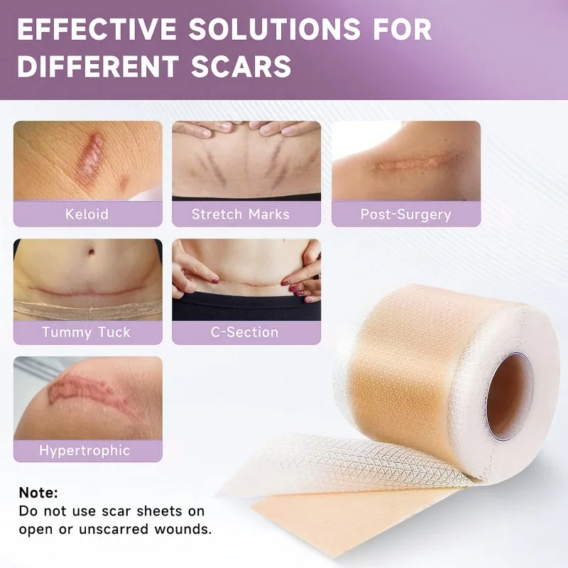 1 Roll 4x100cm Silicone Gel Scar Sheet Roll C Section Stretch Mark Tape Invisible Skin Tone Adhesive Patch Bandages