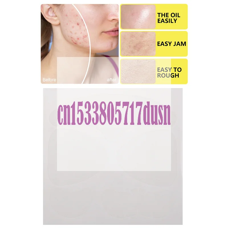 {HBA17} 1セット 大型ハイドロコロイドフルフェイスニキビパッチ ニキビ除去スキンフェイスクリーニング 鼻、顎、額、頬用