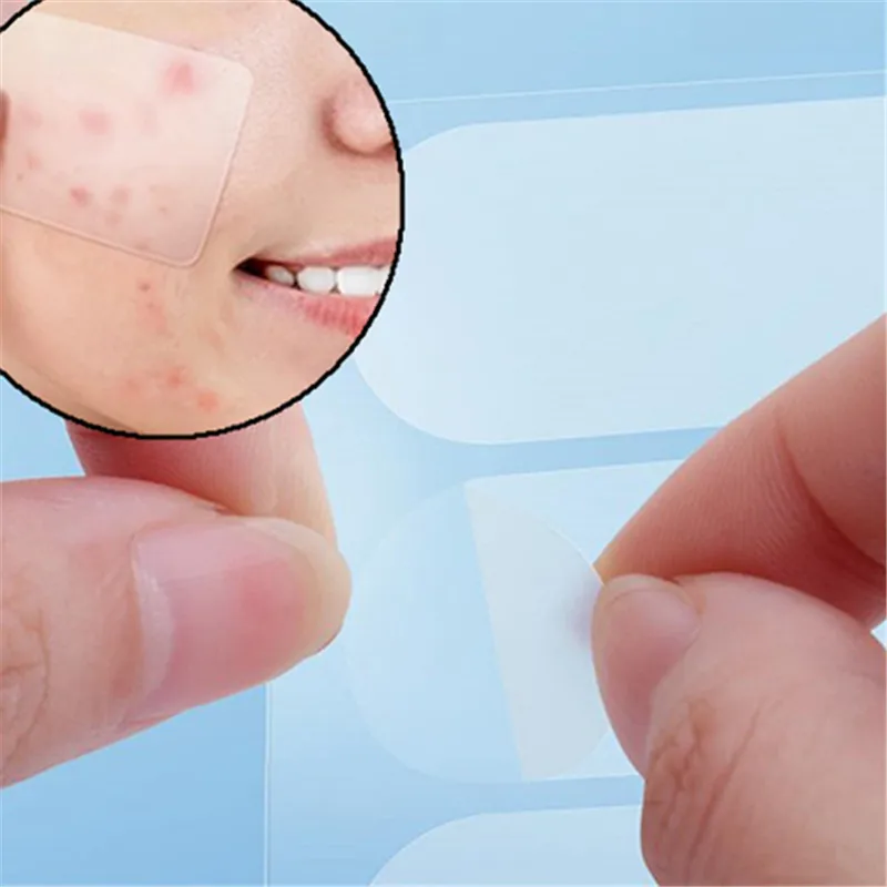 380 unids/set especificación múltiple parche Irregular para acné pegatina para el cuidado de la piel herramienta de maquillaje herramientas para el cuidado Facial