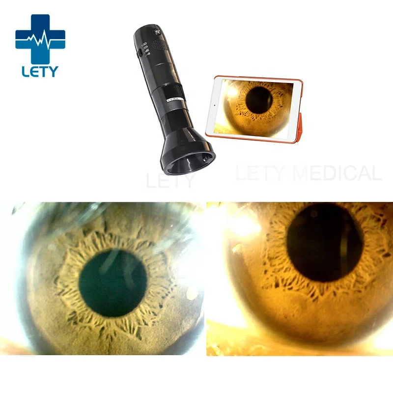 WIFI Ophthalmoscope wireless Iris endoscopy wireless portable digital microscope