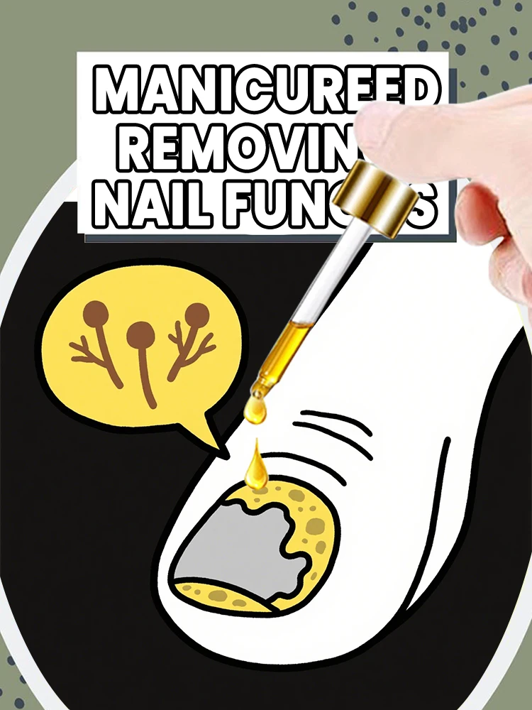 

new Tea Tree for Fungus Care tool 10ml Foot care tools Nail Care Daily Care tool