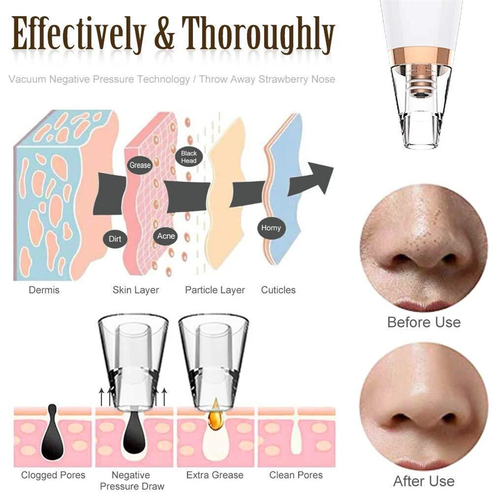 Instrumento de beleza portátil para cuidados com a pele, Poros profundos, Acne, Remoção de espinhas, Produtos de beleza, Lavagem, Sucção forte, Ferramenta silenciosa