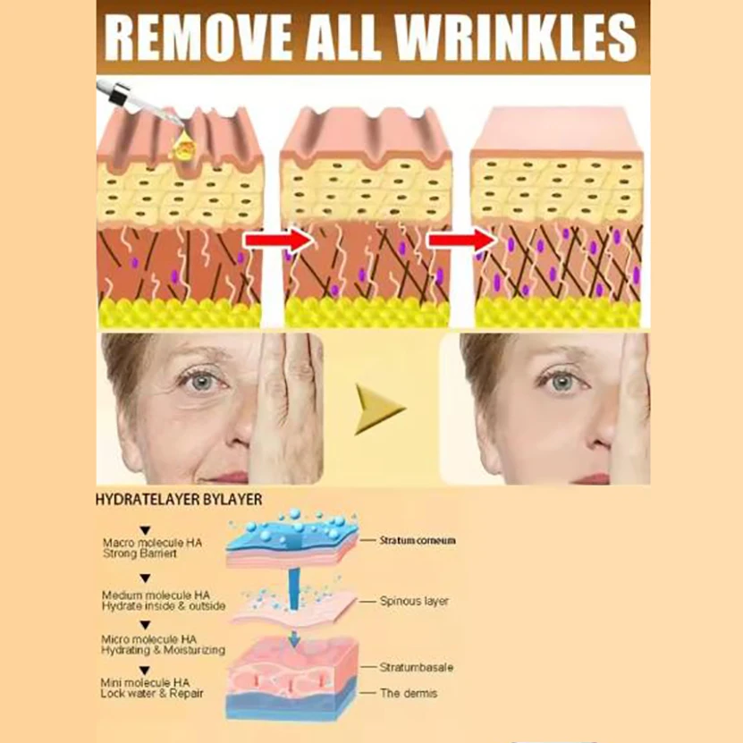 The difference between before and after wrinkles is surprisingly significant! skincare set