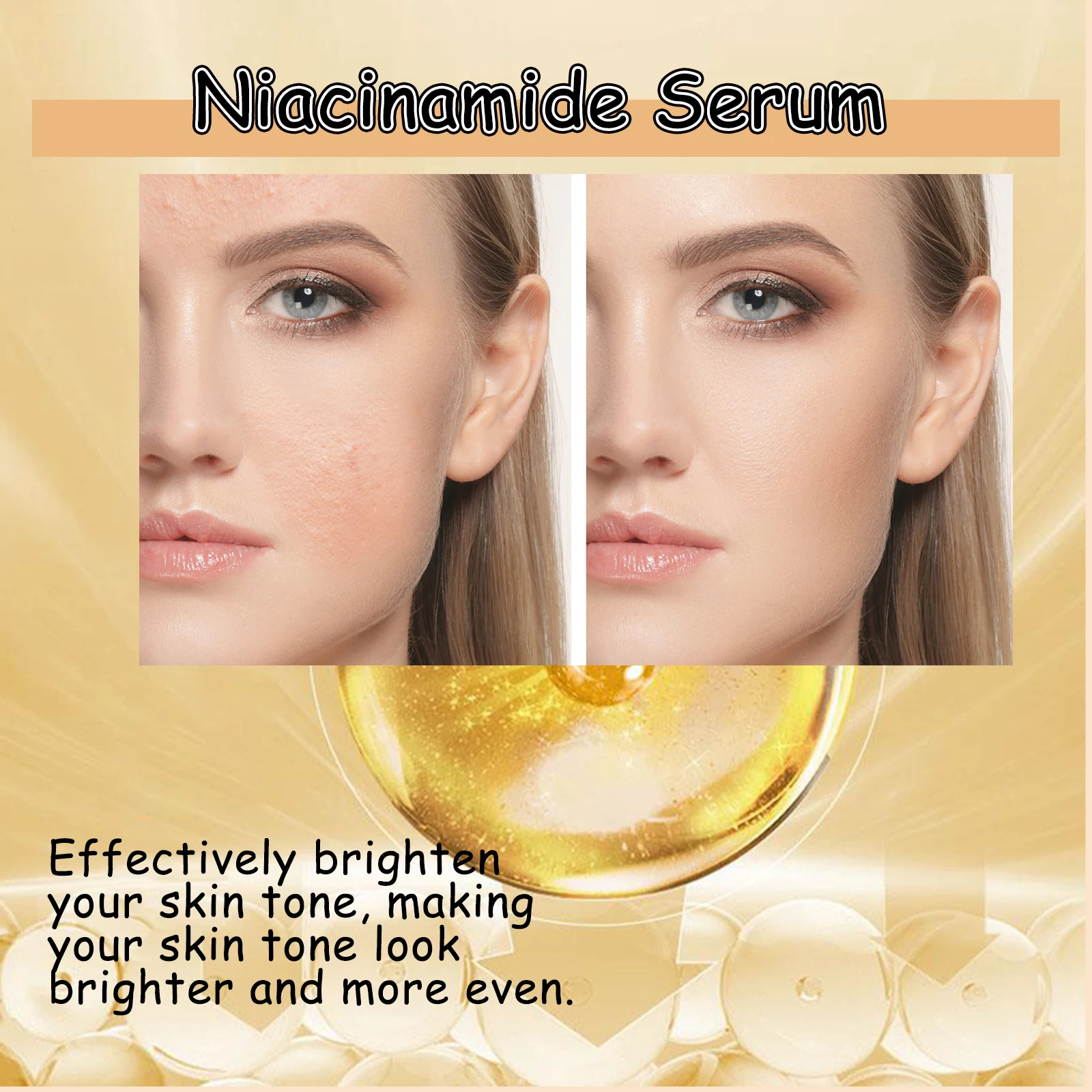 Nicotinamide Gezichtsserum Ver - Niacinamide Pore Shrinking Essence recensie en prijs