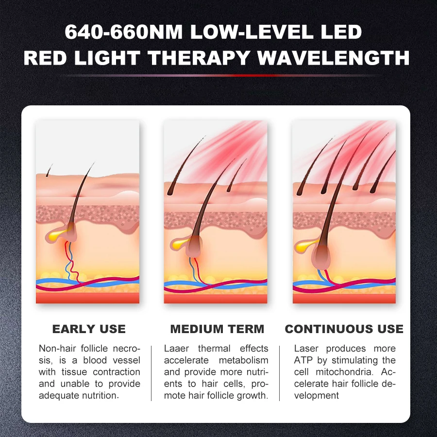 Berretto per la ricrescita dei capelli Dispositivo per la perdita dei capelli laser caldo Trattamento per la perdita Promuovere la crescita dei capelli