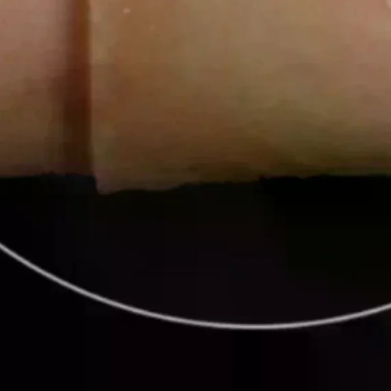 

Scar Therapy Remove Trauma Burn Silicon Patch Reusable Acne Gel Skin Repair New