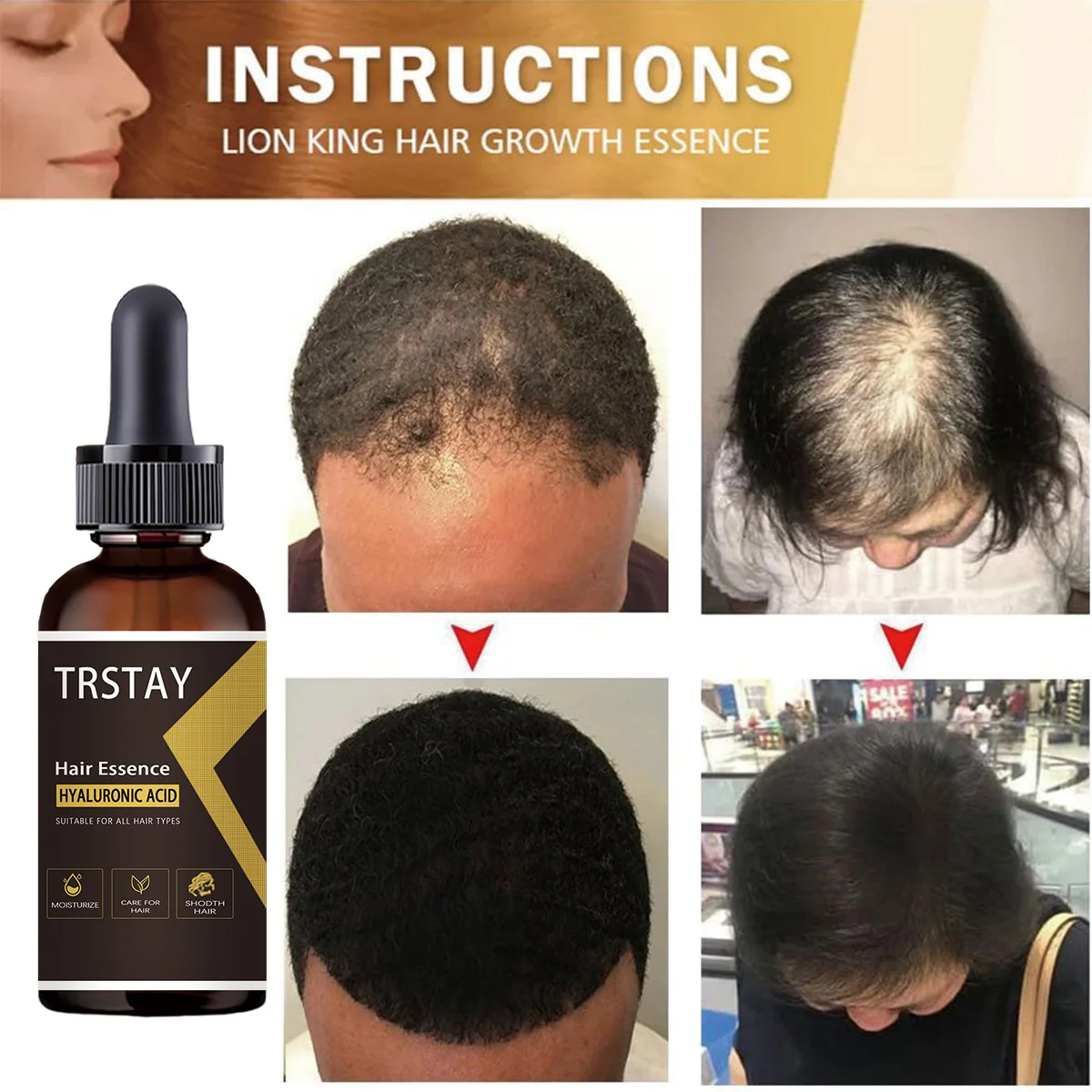 

Hair Regrowth Essential Oils Essence for Man Woman
