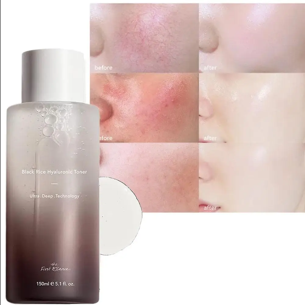 Haruharu Wonder Black Rice حمض الهيالورونيك تونر البشرة الحساسة ترطيب الوجه يحسن لون البشرة الباهتة مهدئا العناية بالبشرة #3
