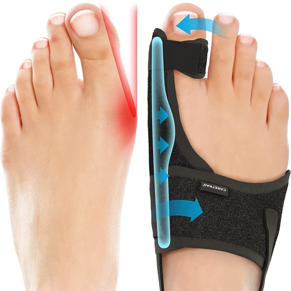 

2Pc Toe Separator Hallux Valgus Bunion Corrector Toe Straightener Foot Relief Orthopedic Pedicure Tools Bunion Finger Protector