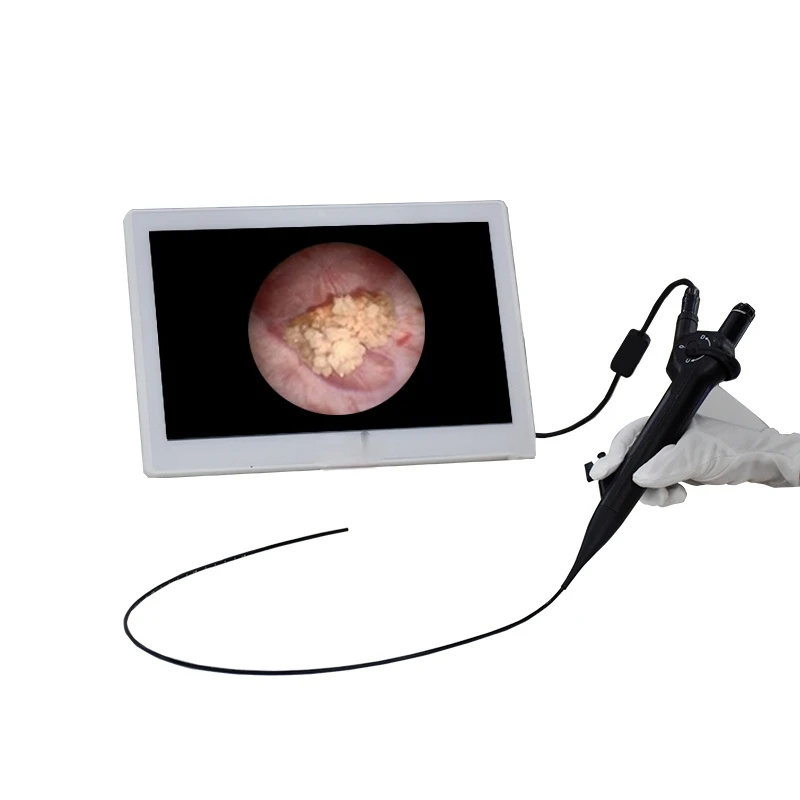 HD Disposable Flexible Video Endoscope Camera Digital Disposable ENT Endoscope Ureteroscope Cystoscope