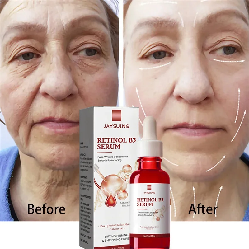 Suero facial reafirmante instantáneo para el cuidado de la piel, líquido antienvejecimiento para eliminar arrugas, Retinol, líneas finas, blanqueamiento, productos coreanos