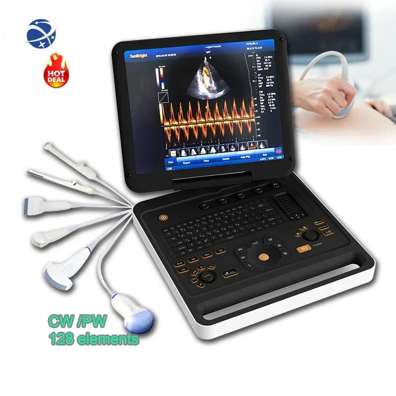 Best price  laptop ultrasound machine/Hand-carried Portable 3D 4D Color Ultrasound Doppler for hospital