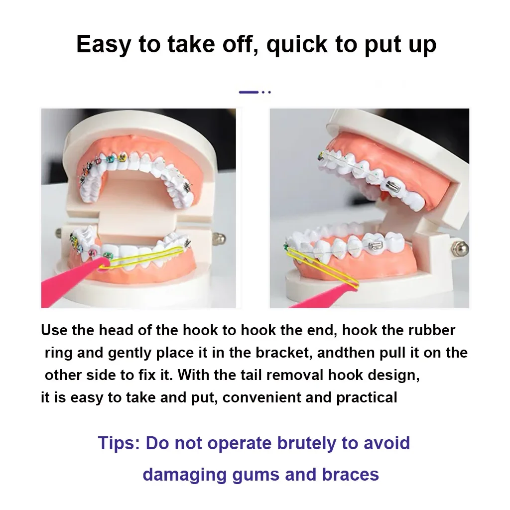 Placers elásticos ortodônticos dentários para suporte de aparelho, faixa de borracha para odontologia, gancho, ferramenta de anel de ligadura, acessórios de odontologia