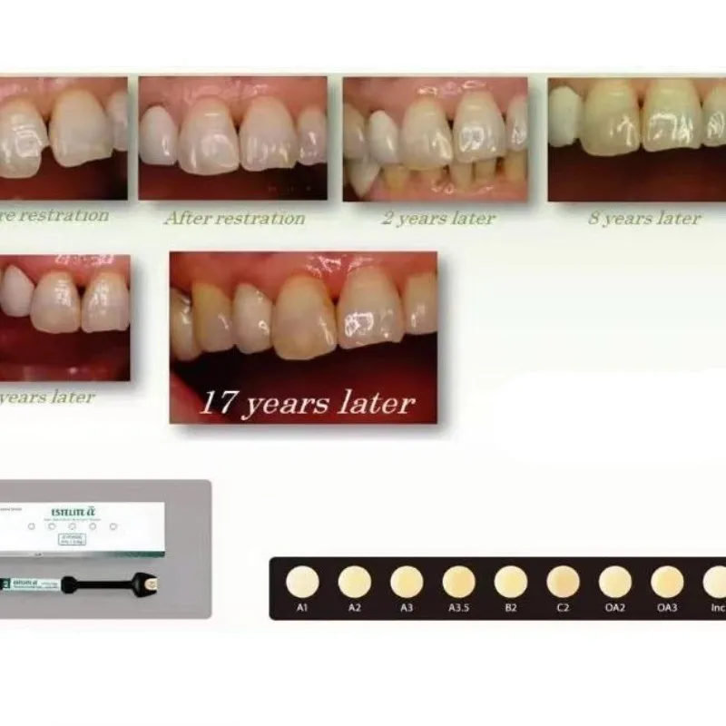 3.8g/주사기 치과 재료 나노 충전 수복 레진 토쿠야마 레진 ESTELITE 광중합 복합 레진 재료