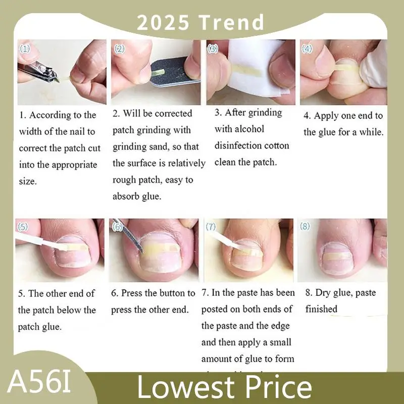 

Hot Sale PARON Ingrown Toenail Pedicure Tool 40Pcs/Bottle Straightening Clip Curved Bs Brace Toenails Thick Paronychia Correctio