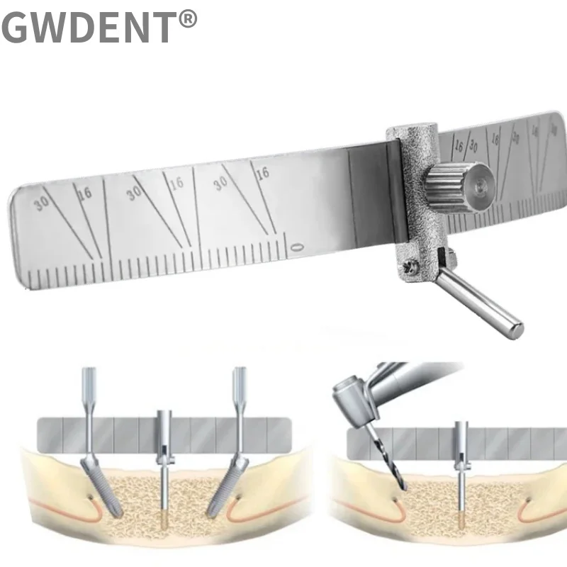 Dental Implant Locating Guide Surgical Planting Positioning Locator Angle Ruler Guage Autoclavable