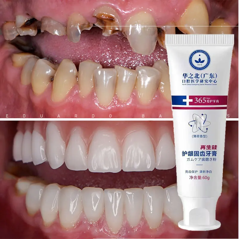 New Upgrade Quick Repair of Cavities Caries Removal of Plaque Stains Decay Whitening Yellowing Repair Teeth Teeth Whitening