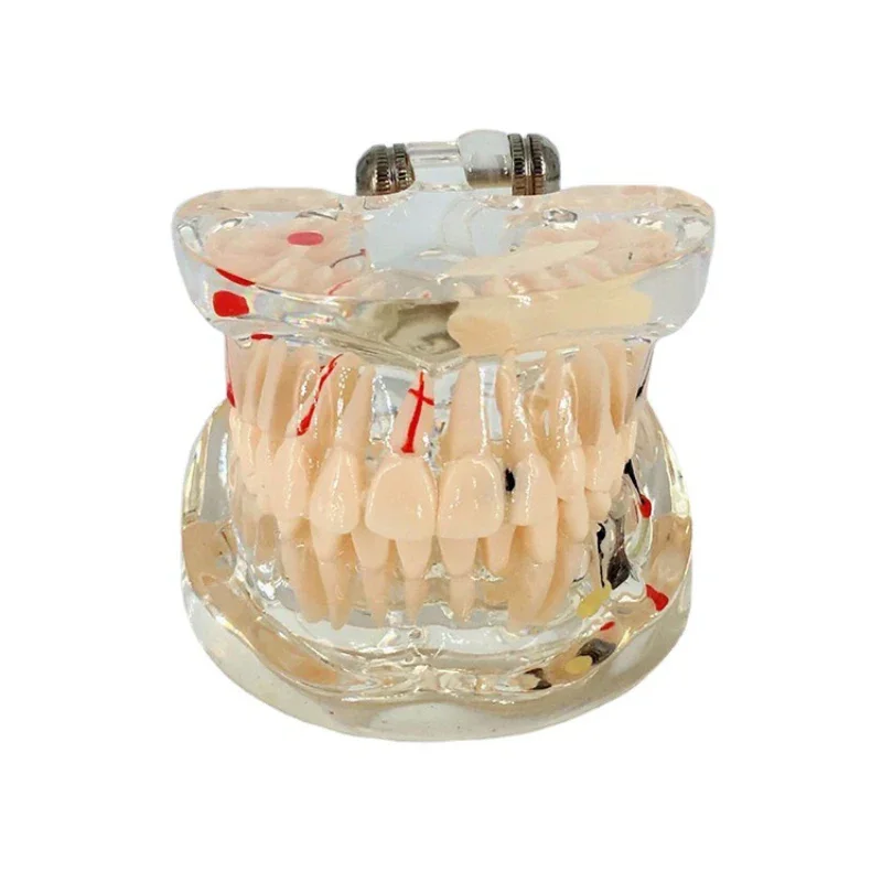 

Dental Teeth Model For Studying Education Transparent Tooth Implant Model