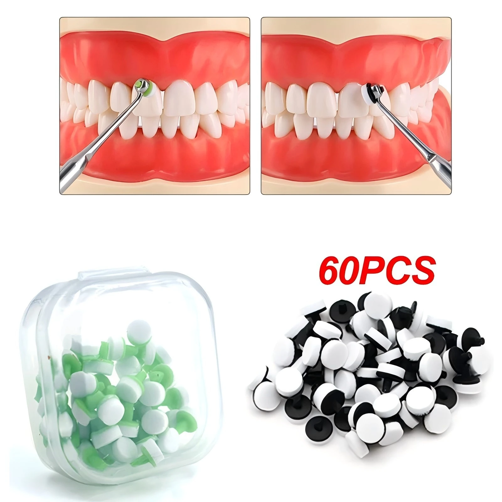 

60 шт./упак. Стоматологические инструменты для формирования композитных пломб: поролоновые подушечки для виниров, материалы для реставрации зубов, инструменты для отбеливания зубов