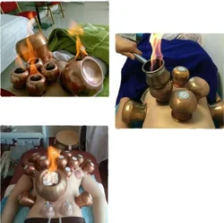 Mongolia Copper Fire Cups Chinese Medical Vacuum Cupping Therapy Body Tuina Massage Massotherapy Stress Relief Health Care