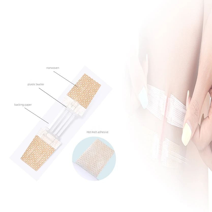 

1PC Zipper Tie Wound Closure Patch Hemostatic Patch Wound Fast Without Suture Zipper Outdoor Band-Aid Portable Quick Clot Wound