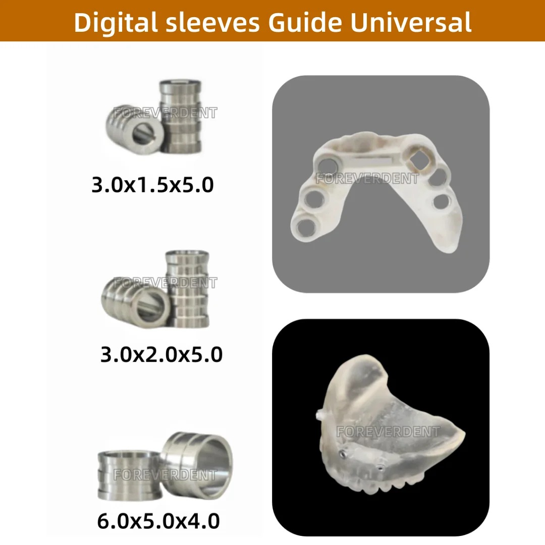 10 قطعة من الأكمام الموجهة الرقمية DIO للأسنان قالب تخطيط التصنيع الرقمي موضع الحفر 11 مقاسًا #5