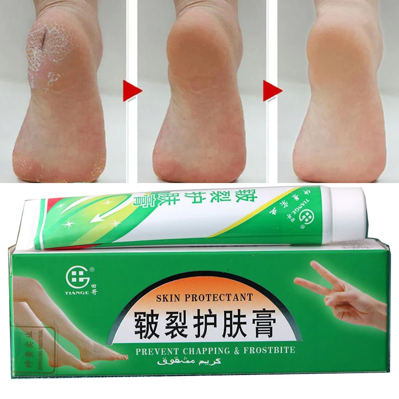 

Оригинальная китайская косметика, крем для рук, крем для пилинга, восстанавливающий пятку, потрескавшийся, антисухая мазь, отшелушивающий