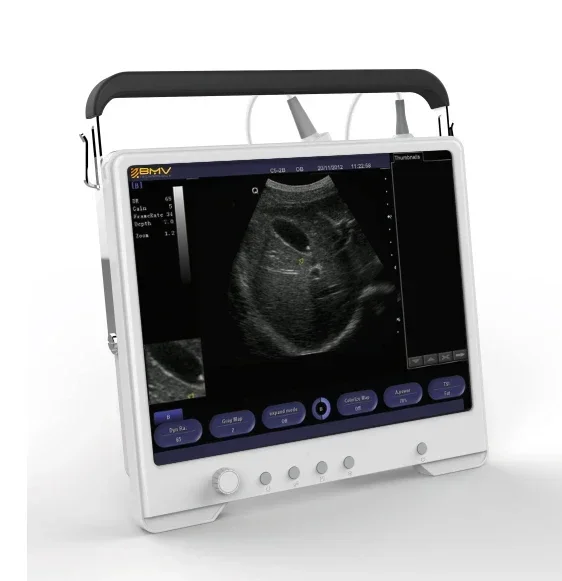 

Digital Laptop TS20 Portable Ultrasound Scanner Ultrasound Device TS20