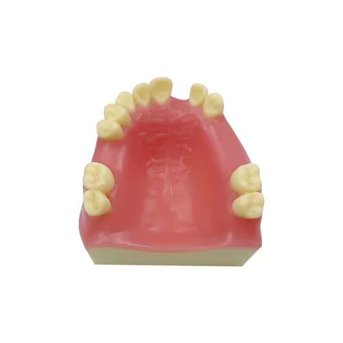 Imagen 2 del producto Modelo de implante dental maxilar, parte faltante del modelo del diente con encías blandas, modelo básico de entrenamiento de implantes, herramientas de dentista, 1 Uds.