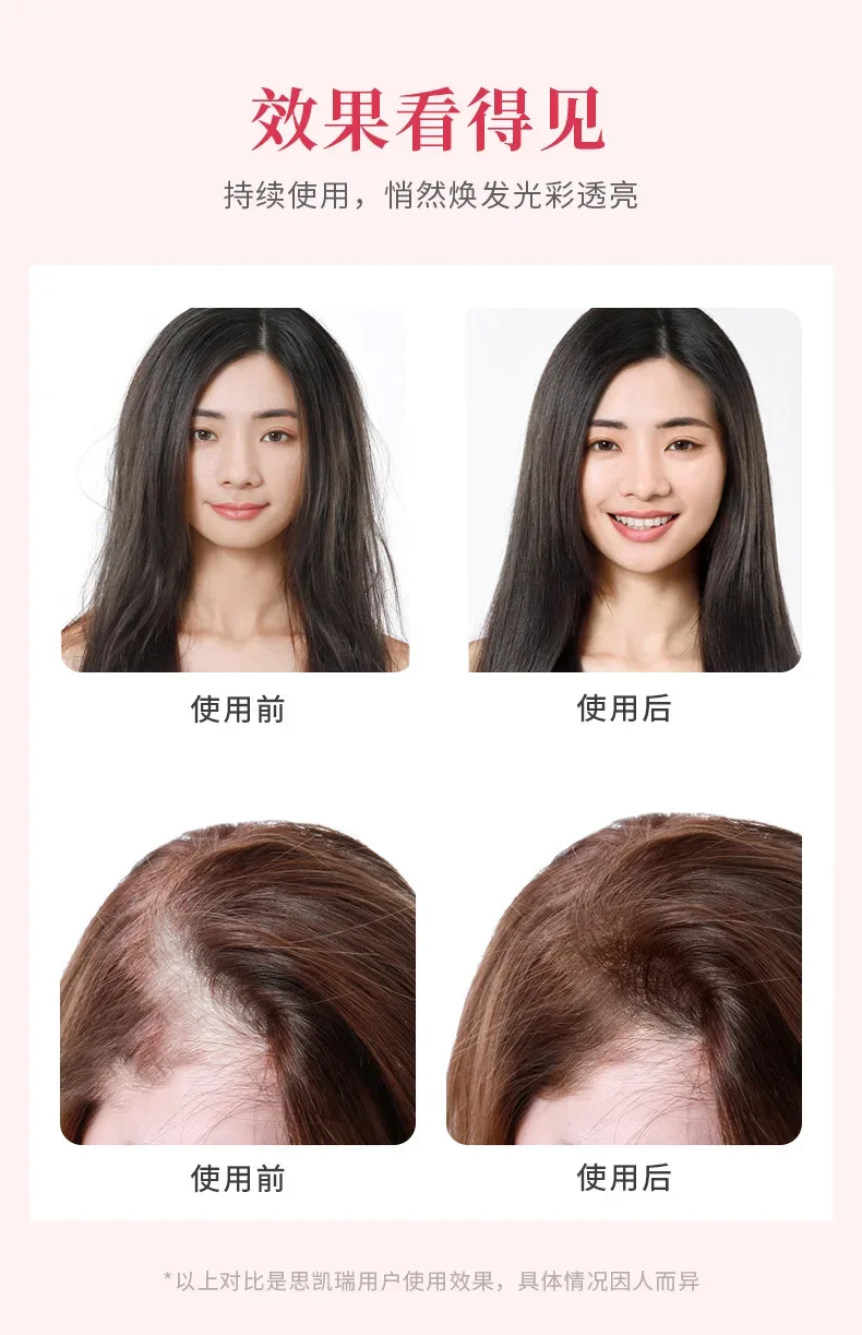 Electric Colorful Light Hair Care Massage to Reduce Hair Loss