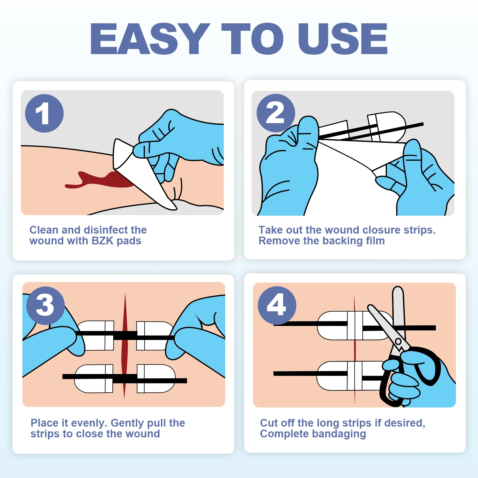 Aid Mate Emergency Laceration Strips Skin Closure Device Repair Wounds Without Stitches,Complete Kit to Clean, Close,Cover Wound