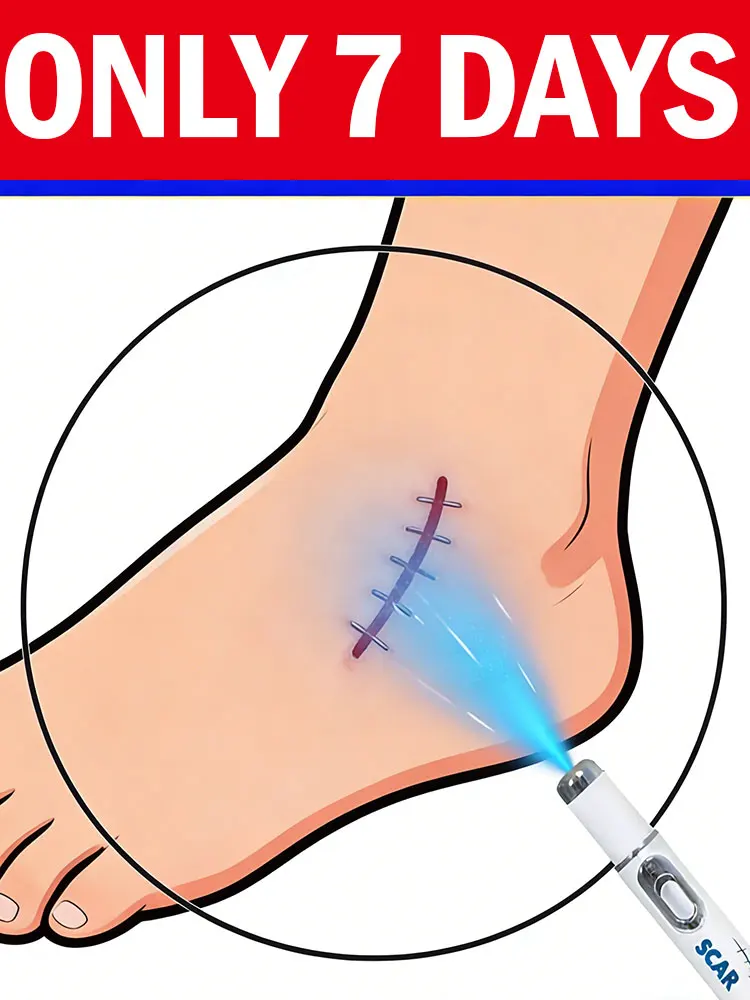 

Новый продукт Синий свет лазера Уменьшите шрам